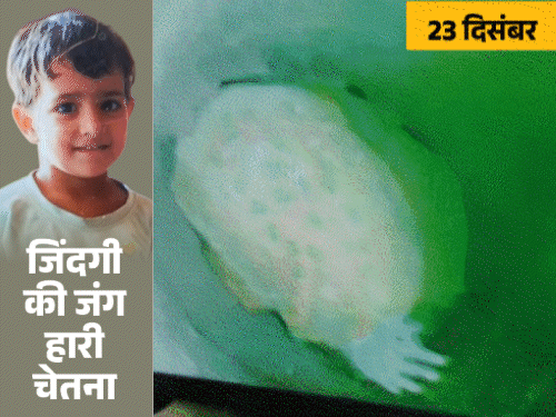 Chetna, who came out of the borewell after 10 days, died: She was taken out wrapped in a cloth in an unconscious state, was stuck at a depth of 170 feet