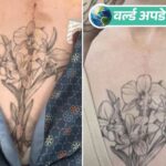 World Updates: After open heart surgery, doctor reattached chest tattoo, woman shared photos on social media